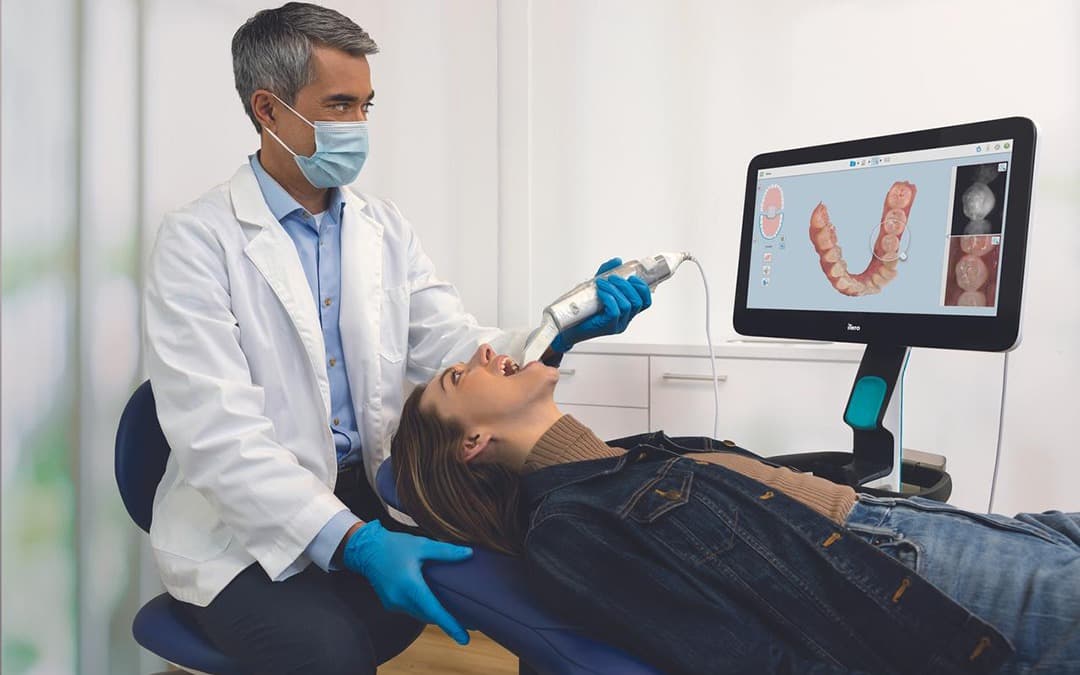Escaneamento intraoral 3D digital realizado com scanner odontol&oacute;gico de alta precis&atilde;o - Radix Radiologia Taquaritinga